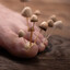 Toe Fungus