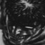 ff|JUNKIEKISS