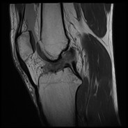 pruszków opole welcome to