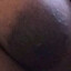 Obese Black Mans Nipple