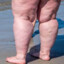 Leg