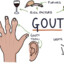 THE GOUT FATHER