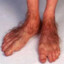 hairy hobbit toes