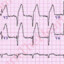 Cardiologue