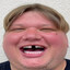 Pimpyl