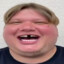 P1mple