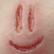 𝕆𝕠𝕠𝕠𝕡𝕤~