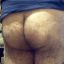 Hairy Buttocks