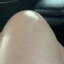 Shiny Knee