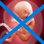 FetusDeletus