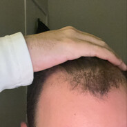 Not bald I'm just getting + head