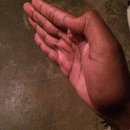 Kobe Ran out of Lowgrade
