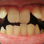 кривые зубы   CS.MONEY
