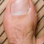 Big Toe