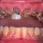 Dental Pain DMD