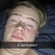 DumleKongen