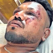 Air India Seat 11A Survivor