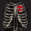 RibCage