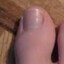 daddy toe