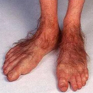 hairy hobbit toes