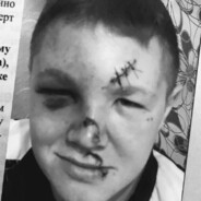 гадючка такая