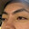 napes