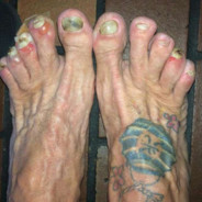 SmellYoToes