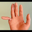 Myfingerbroke