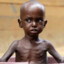Starving African Kid