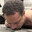 cole allen's rugburn