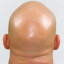 *&lt;)bald