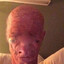 Scrotus