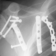 Russell - steam id 76561197960715036