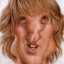 Owen Wilson&#039;s Nose