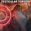 Testicular Toorsion