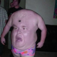 RAB