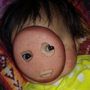 Surgeファックユー